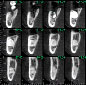 ct-scan